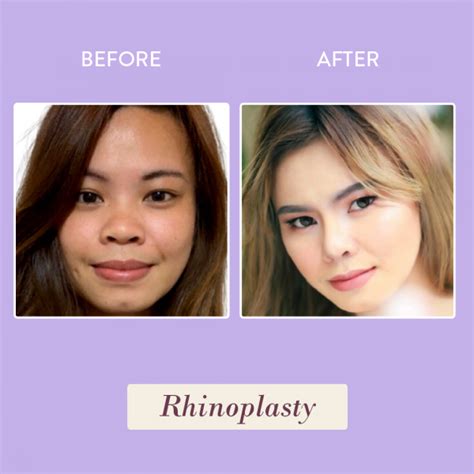 Plastic Surgery PH .